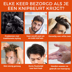 6 foto's van mannen die de Hair Gel willen gebruiken omdat ze problemen hebben met hun haar, met als voorbeeld roos en styling problemen.