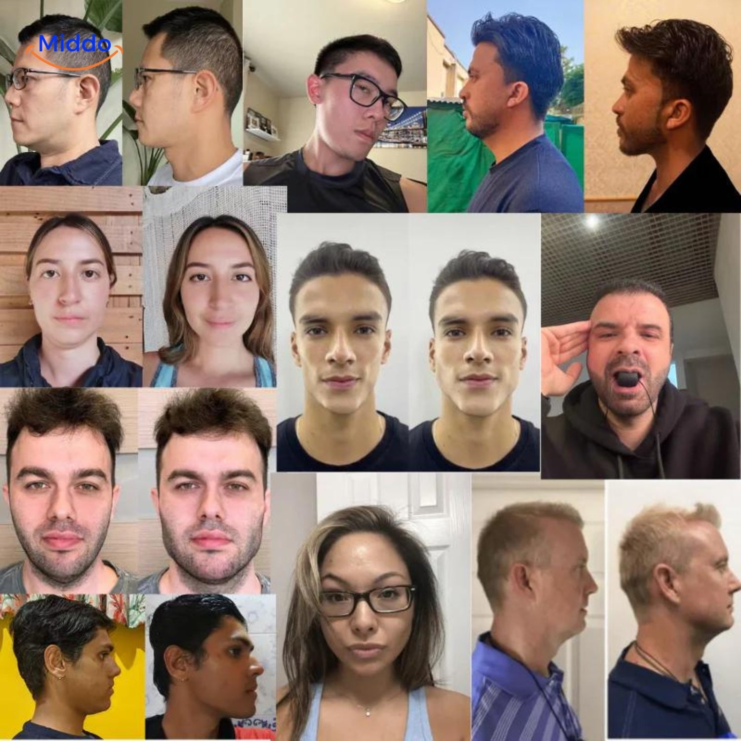 KaakMaster Pro resultaten collage van voor en na gezichtsveranderingen.