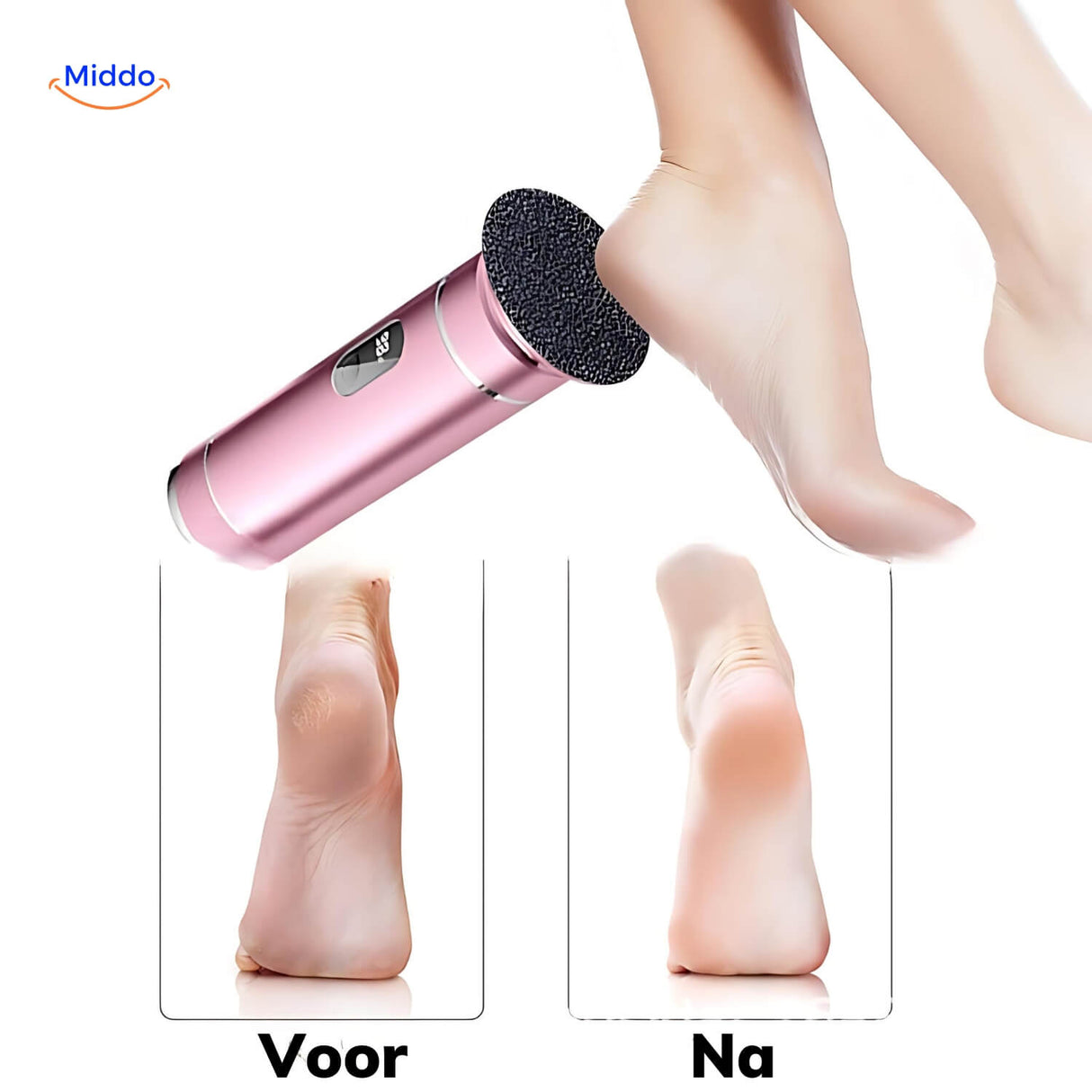 résultat avant et après utilisation de la limeuse pieds zapsole, peau lisse sans callosités