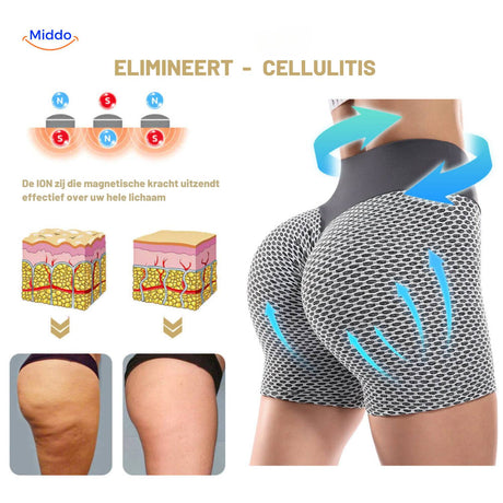 short yoga gainant : illustration des différents types de cellulite et textures de peau